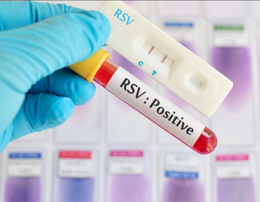 Respiratory Syncytial Virus (RSV)